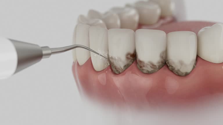 Reliable Teeth Whitening contractor in Sequoyah County County, OK by Dentist Open Now